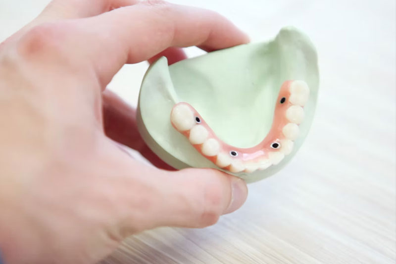 Cosmetic Dentist in Leesburg