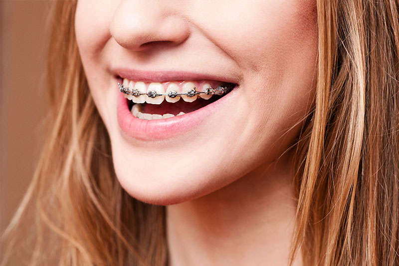 Orthodontics in Leesburg